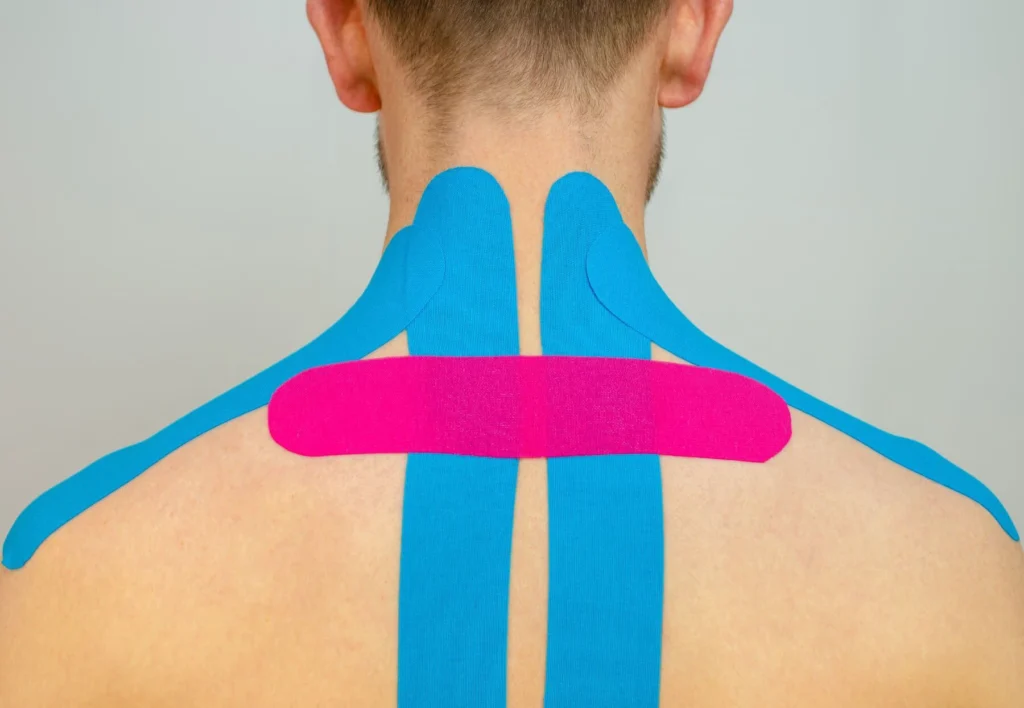 Kinesio Taping